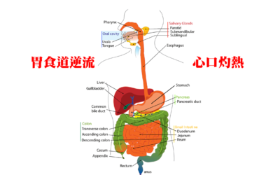 改善胃食道逆流